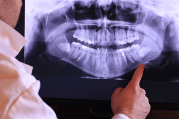 Best Broken or Cracked Tooth Emergency Dentist in Sterling, CO