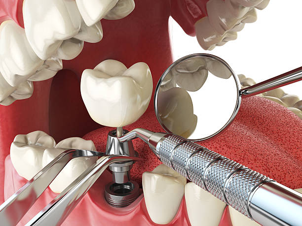 Best Emergency Dental Services for Seniors in Sterling, CO